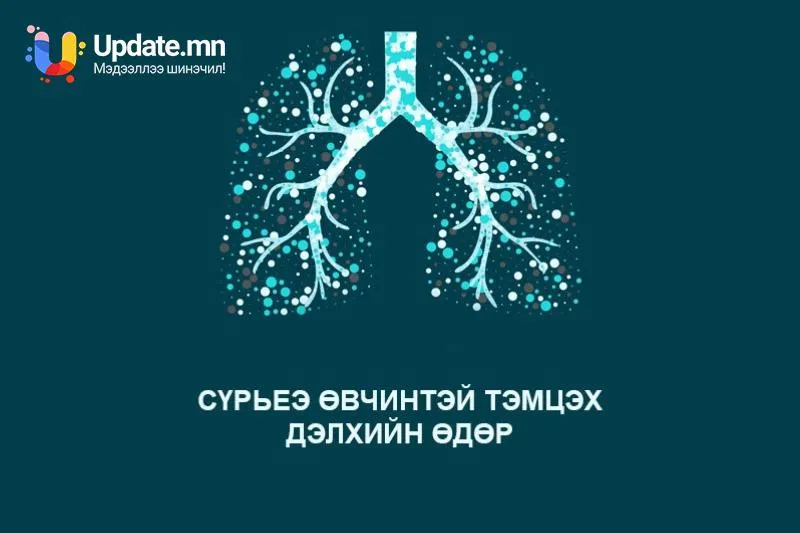 Энэ жил “Сүрьеэ өвчинтэй тэмцэх Дэлхийн өдөр”-ийг "БИД СҮРЬЕЭГ УСТГАЖ ЧАДНА” уриан дор тэмдэглэн өнгөрүүлэн